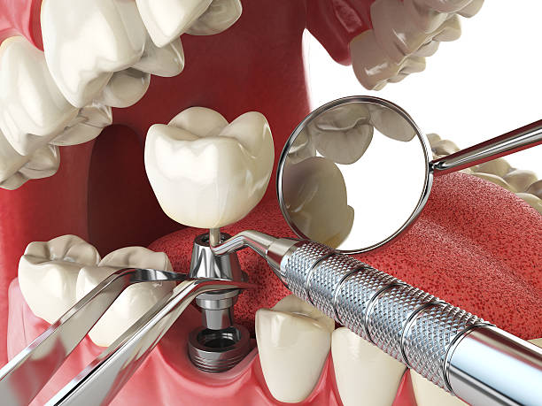 Best Emergency Dentist for Special Needs Patients in Monument Hills, CA