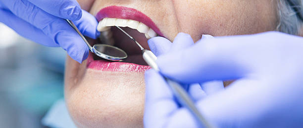 Best Emergency Dental Services for Seniors in Monument Hills, CA